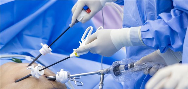 Epigastrischer Zugang zur Gallenblasenentnahme reduzierte in Studie das Risiko für Trokarhernien Nahaufnahme der Hände des Chirurgen-Teams während der Operation zur Entfernung der Gallenblase mit chirurgischen Laparoskopie-Instrumenten.