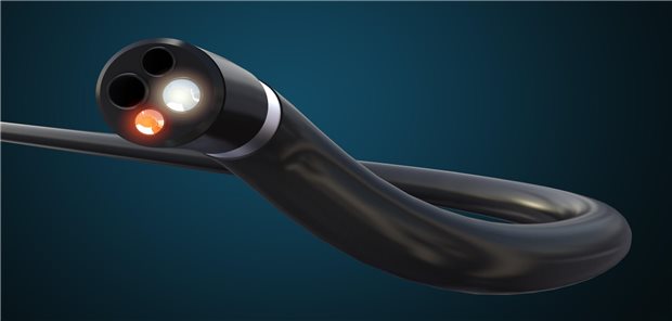 Zahl der Darmkrebs-Todesfälle deutlich gesunken 3D-Illustration eines Koloskops.