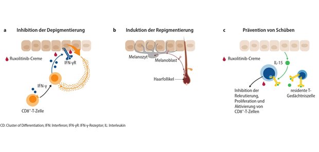Zielgerichtete Therapie mit günstigem Wirksamkeits- und Sicherheitsprofil Abb. 1: Wirkmechanismus von Ruxolitinib-Creme