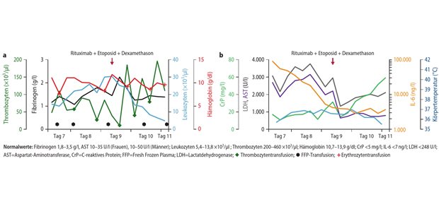 Ergibt sich aus dieser Symptomtrias eine eindeutige Diagnose? Abb. 2: Verlauf der HLH-Parameter (a) und Entzündungsparameter (b) bei einem pHLH-Patienten zwischen Aufnahme ITS (Tag 7) und Tod (Tag 11)