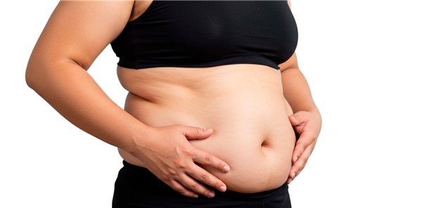 Abdominale Adipositas fördert entzündliche Zytokine und Hormone und führt zu Insulinresistenz, Dyslipidämie, Bluthochdruck und gestörter Glukoseregulation.