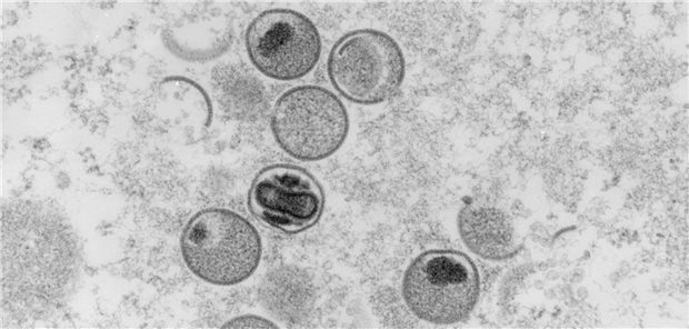 MPXV, Monkeypox virus. Transmission electron microscopy, ultrathin section. Bar = 200 nm. Freya Kaulbars (2004)