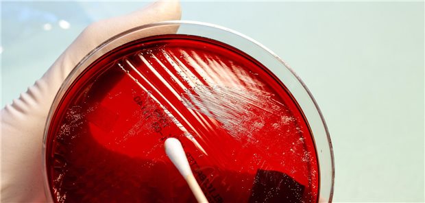 Agarplatte: Welcher Mikroorganismus steckt in diesem Abstrich? Das wird sich zeigen.  Labor28