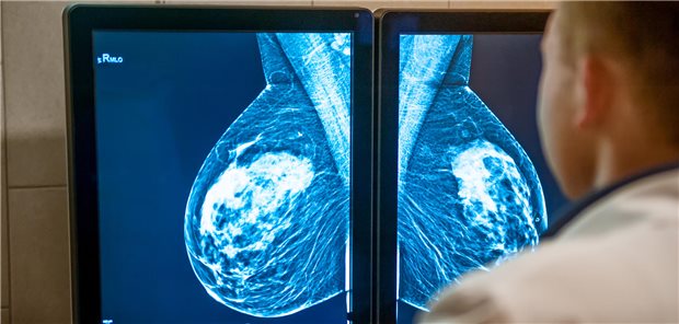 Arzt betrachtet die Aufnahme einer Mammografie.