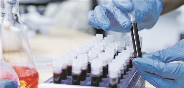 Arbeit mit Bluttests im Labor