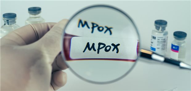 Im Labor wird eine Probe mit der Beschriftung mpox untersucht.