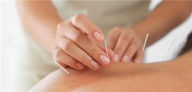 Auch wenn es wenig Studien gibt: Traditionelle Chinesische Medizin kann nach Einschätzung von Fachleuten Kranken helfen. 