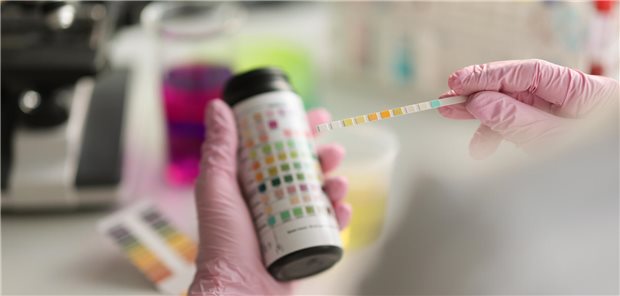 Für wen könnten Harnwegsinfekte gefährlich werden? Eine Ärztin hält einen Reagenzstreifen zur Analyse einer Urinprobe in der Hand.