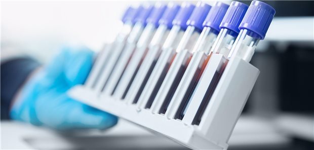 Automatische Bearbeitung von Blutproben im medizinischen Fachlabor.