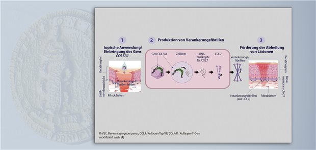 B-VEC wird mittels Herpes-simplex-Virus-basierter Transduktion in Keratinozyten und Fibroblasten eingebracht. Es kommt zur Synthese von COL7, wodurch Epidermis und Dermis besser verankert werden, was die Wundheilung fördert.  Krystal Biotech