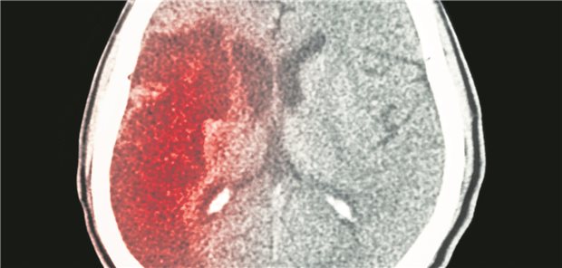 Bei Grenzentscheidungen (z.B. kürzlich stattgehabte Operation) gelte es, Rücksprache mit der entsprechenden Fachdisziplin zu halten, betont Dr. Milani Deb-Chatterji.