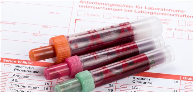 Bei Laborleistungen sind die Ausnahmekennziffern mit zu beachten.