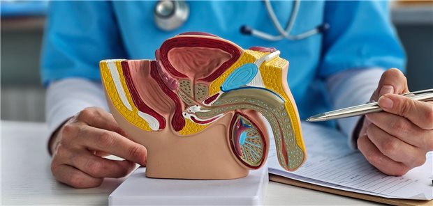 Verzögerte Hodenkrebs-Therapie: Ab Woche acht wird es kritisch Ein Urologe erklärt einem Patienten mit Hodenkrebs anhand eines Anatomiemodells der männlichen Genitalien die Diagnose und die Behandlung.