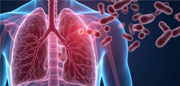 Ein Arzt erklärt einem Patienten anhand eines Modells der Anatomie der Lunge die chronische Atemwegserkrankung  Bronchiektasen.