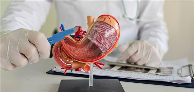 Ein Chirurg hält ein Skalpell über das anatomische Modell des menschlichen Magens, um seinem Patienten das Vorgehen und die Konsequenzen einer Schlauchmagen-Operation zu erklären.