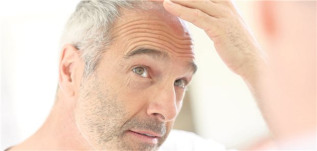 Besorgt, weil die Haare auf dem Kopf weniger werden? Menschen, die sich wegen androgenetischer Alopezie in medizinische Behandlung begeben, beobachteten den eigenen Körper sehr stark, meint ein Kollege beim europäischen Derma-Kongress. (Symbolbild mit Fotomodell)