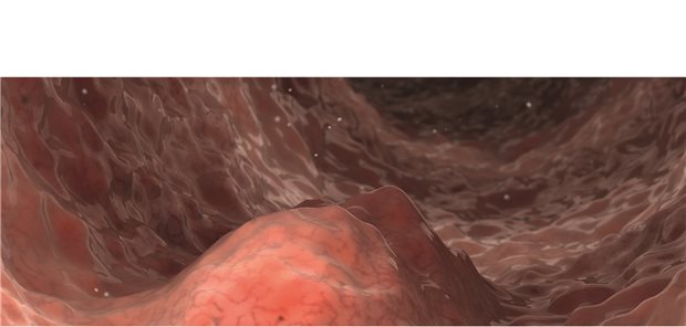 Herausforderungen bei schlechter Prognose Herausforderungen bei schlechter Prognose