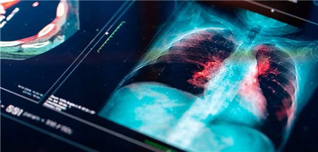 Krebs als Modellerkrankung Krebs als Modellerkrankung