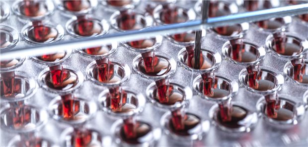 Datennutzung: Patientenperspektive kommt oft zu kurz Datennutzung: Patientenperspektive kommt oft zu kurz