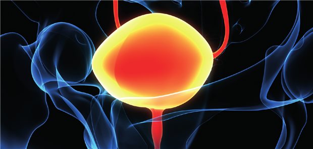 Langzeiterfahrung mit Avelumab als Erstlinien-Erhaltungstherapie Langzeiterfahrung mit Avelumab als Erstlinien-Erhaltungstherapie