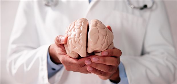 Arzt hält Gehirnplastik in den Händen