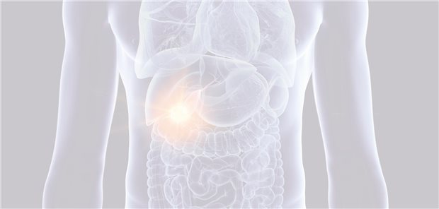 Immun-Chemotherapie als neuer Goldstandard in der Erstlinie Immun-Chemotherapie als neuer Goldstandard in der Erstlinie