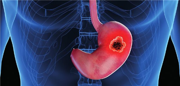 Vorhandene Therapieoptionen für eine optimale Sequenztherapie nutzen Vorhandene Therapieoptionen für eine optimale Sequenztherapie nutzen