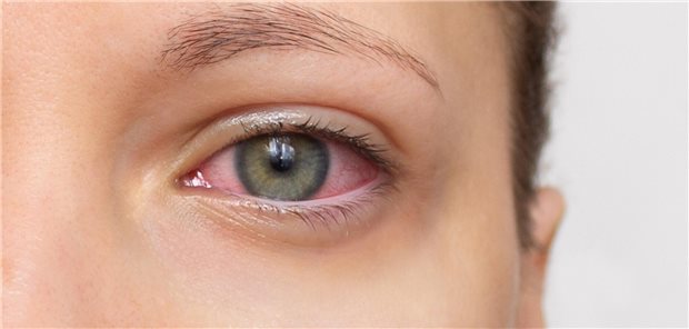 Symptome, Ursachen und Therapie Symptome, Ursachen und Therapie