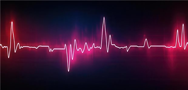 Eine Illustration eines EKG