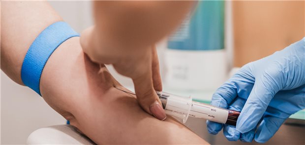 Blutabnahme: Für die Logistik rund um die Testung soll in Zukunft mehr Geld bereitstehen. Die Analytik wird dagegen zu weiten Teilen abgewertet. Insgesamt soll dies laut KBV „leistungsbedarfsneutral“ sein.