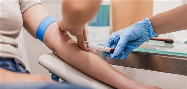 Blutabnahme zum Test auf LDL-Cholesterin: Die ESC/EAS-Leitlinie zum Management von Dyslipidämien empfiehlt für kardiovaskuläre Hochrisikopatienten ein LDL-C-Zielwert von < 55 mg/dl. In der NVL wird ein Wert von < 70 mg/dl angestrebt.