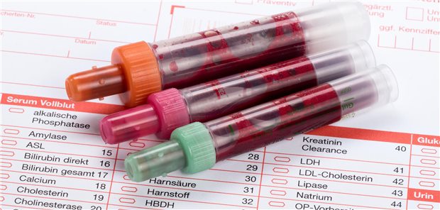 Labore kritisieren Honorarbeschluss als unfair Bluten in eigener Sache? Die Labore beklagen, dass sie Honorarverbesserungen an der einen Stelle mit Einbußen an anderer Stelle selbst bestreiten sollen.