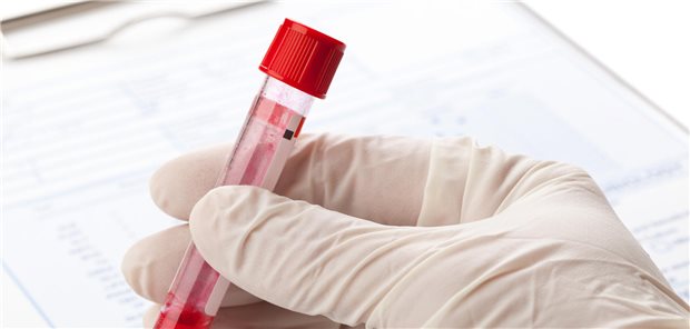 Eine kleines Flächschen mit Blut