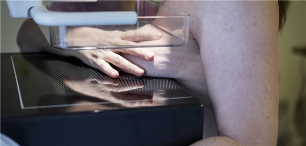 Brustkrebsscreening: Der Blick auf die Gesamtsterblichkeit ist ernüchternd.