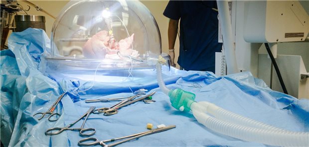 Eine Lunge in einer Druckkammer auf einem Op-Tisch.