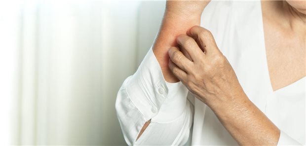 Chronischer Pruritus plagt ältere Menschen häufig Eine ältere Frauen kratzt sich aufgrund eines chronischen Pruritus am Arm.