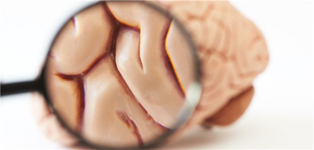 Das Gehirn unter der Lupe. Oft ist es nur mit Bildgebung möglich, der Ursache unklarer zerebraler Symptome auf die Spur zu kommen.
