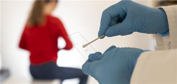 Ein Abstrich wird nach der Untersuchung bei der Frauenärztin oder dem Frauenarzt gemacht.