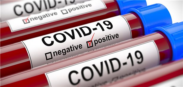 Zur Coronavirus-Themenseite Das neue Coronavirus SARS-CoV-2- hält die Welt in Atem.