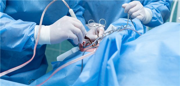 Wie sinnvoll ist die Untersuchung routinemäßig entfernter Tonsillen auf Krebs? Der HNO-Arzt führt eine Tonsillektomie (Entfernung der Mandeln) in einem sterilen Operationssaal durch.