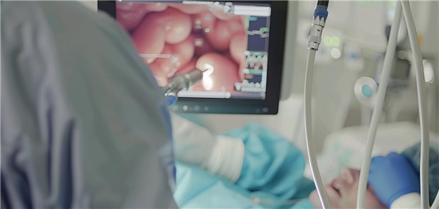 ERCPs in Deutschland: Besser mehr Qualität als Quantität Die Autorinnen und Autoren machen in einem Zeitschriftenbeitrag einen Vorschlag zur Verbesserung der ERCP-Qualität in Deutschland. Denn die Komplikationsraten sind mit schätzungsweise 7 bis 14 Prozent, in aktuellen Studien sogar bis 25 Prozent, hoch.