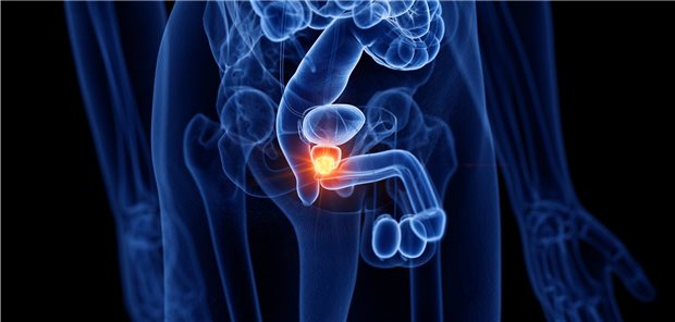 Die Diagnoseprävalenz von Prostatakrebs betrug 2019 im Bundesschnitt 2,19 Prozent.