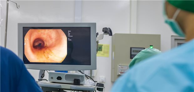 Die Koloskopie ist invasiv, kann aber Krebsvorstufen erkennen. Mit dem FIT hingegen lassen sich nur Tumoren im frühen Stadium detektieren.