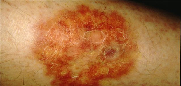 Schild eines Hautarztes mit den Öffnungszeiten.