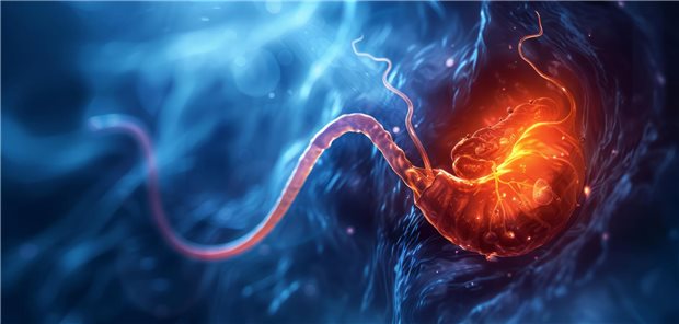 Akute Cholezystitis bei multimorbiden Älteren: Operation nicht sofort ausschließen! KI-Illustration einer Gallenblase mit Stein