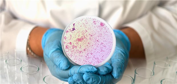 Häufung von Tetrazyklin-Resistenzen – die Kehrseite der Doxy-PEP? Eine Frau hält einen Abstrich von Gonokokken in die Kamera.