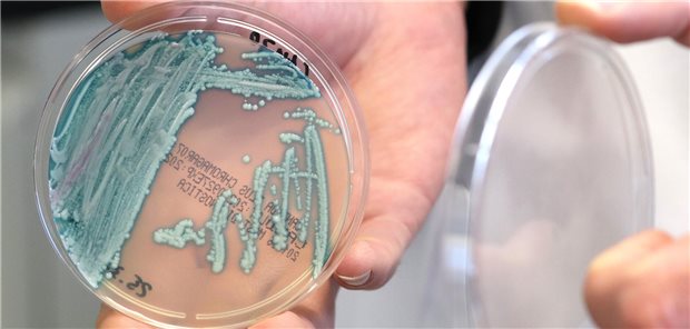 Candida auris: Der richtige Umgang mit einem expansiven Hefepilz Petrischale mit Pilzkolonien