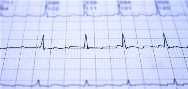 Ein Elektrokardiogramm ist zu sehen. 
