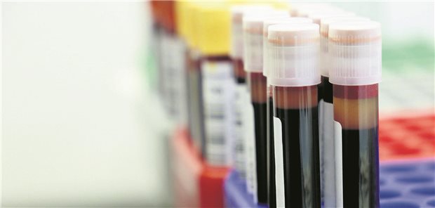 Mehrere Röhrchen mit Blut stehen aufgereiht im Labor