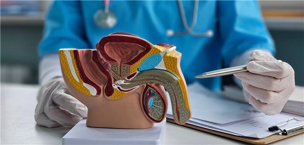 Ein Arzt berät einen Patienten mit Prostatakrebs hinsichtlich der Behandlung anhand einen anatomischen Modells.